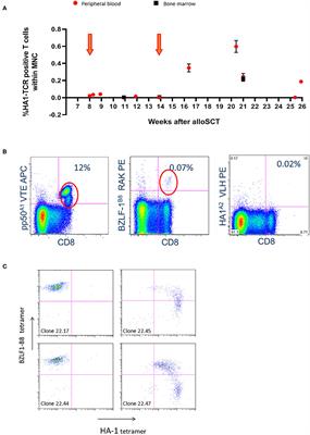 HA-1H T-Cell Receptor Gene Transfer to Redirect Virus-Specific T Cells for Treatment of Hematological Malignancies After Allogeneic Stem Cell Transplantation: A Phase 1 Clinical Study